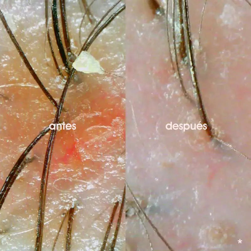 Miriam Quevedo Black Baccara Cellular Breathing Multiplying Scrub Scalp Mask 200ml