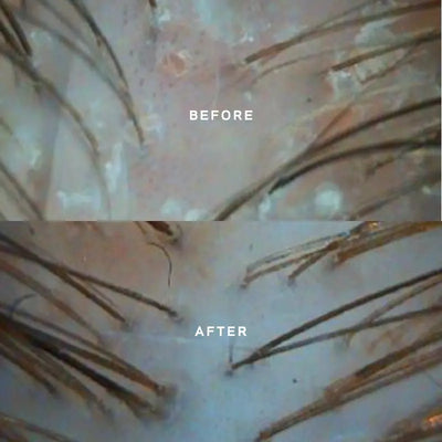 Miriam Quevedo Black Baccara Scalp Concetrate + Pre-Treatment Exfoliator 30+10ml