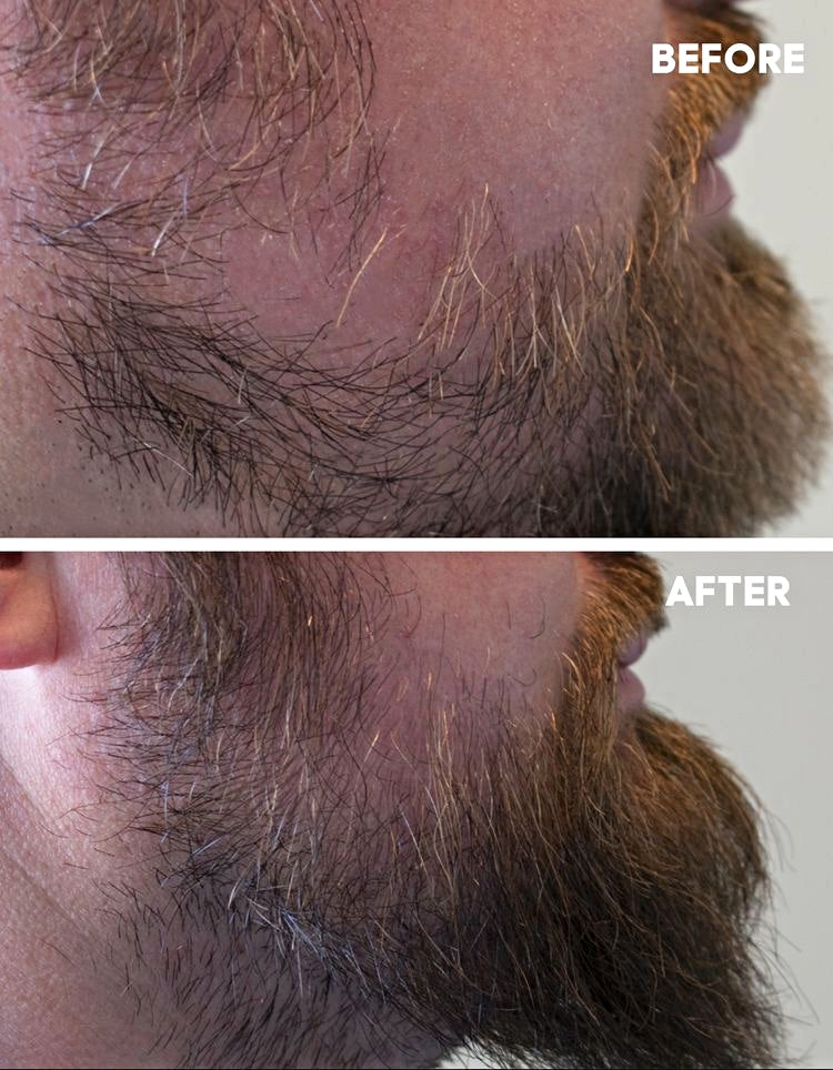 Hår og Skjegg Serum 100ml