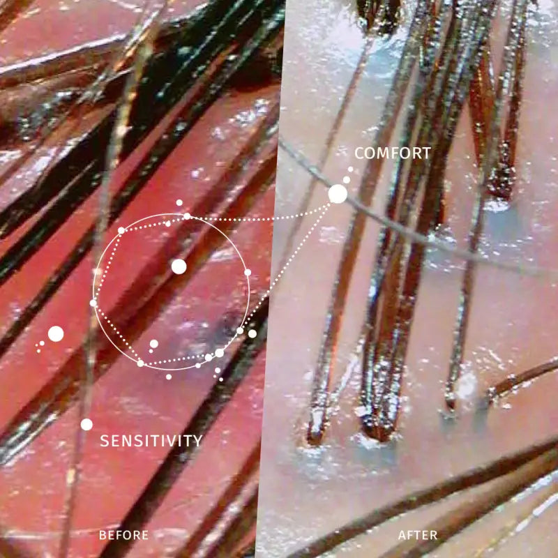 Glacial White Caviar Sensitive Scalp Comforting Ritual